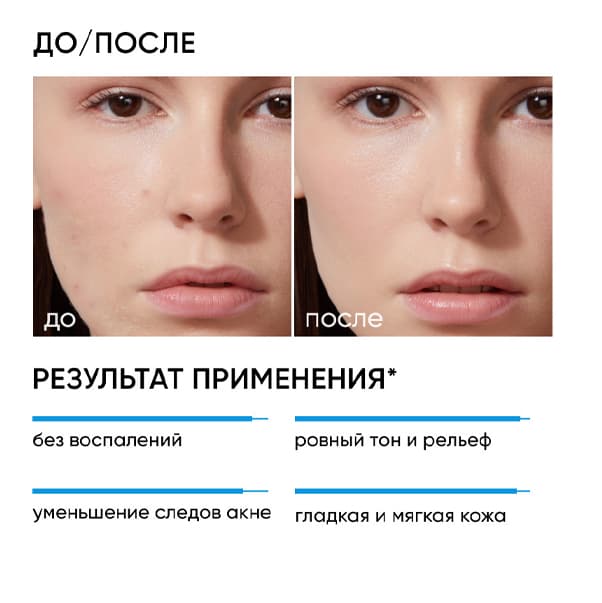 RE:PROGRAM Пилинг 11% для проблемной кожи