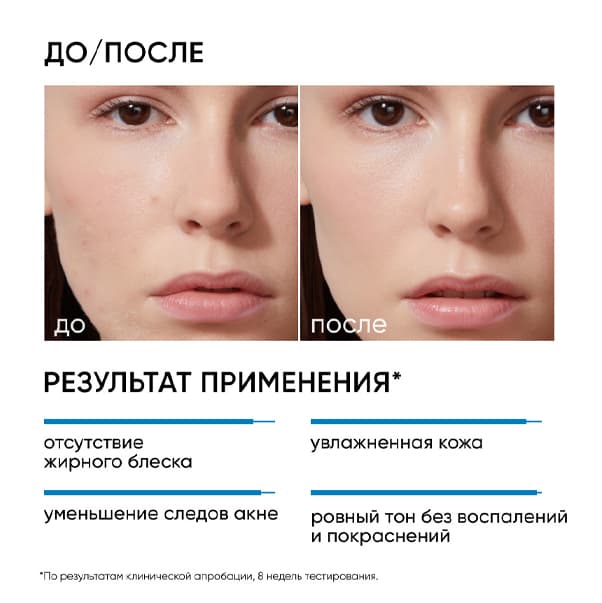 RE:PROGRAM MOIST&HEAL Увлажняющий крем для кожи, склонной к акне