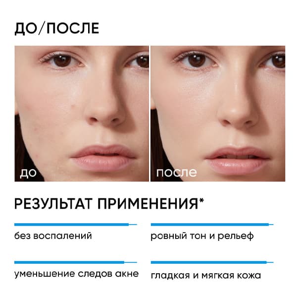 RE:PROGRAM Пилинг 18% для проблемной кожи