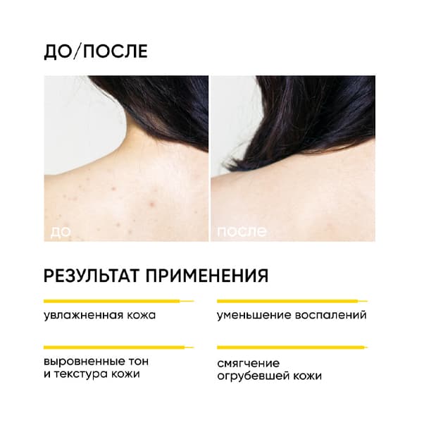 SMART SKIN RENEWAL Обновляющий крем для тела с кислотами